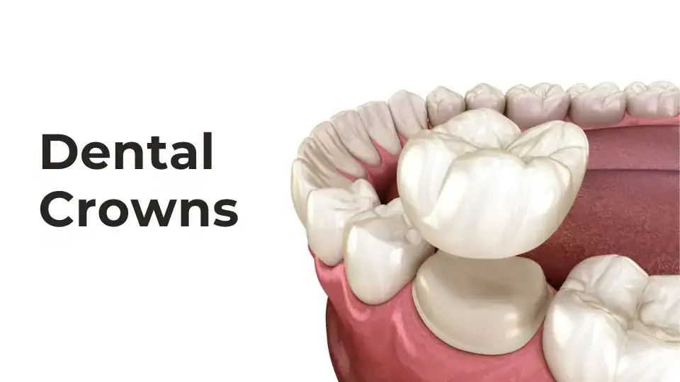 Dental Crowns Video Cover