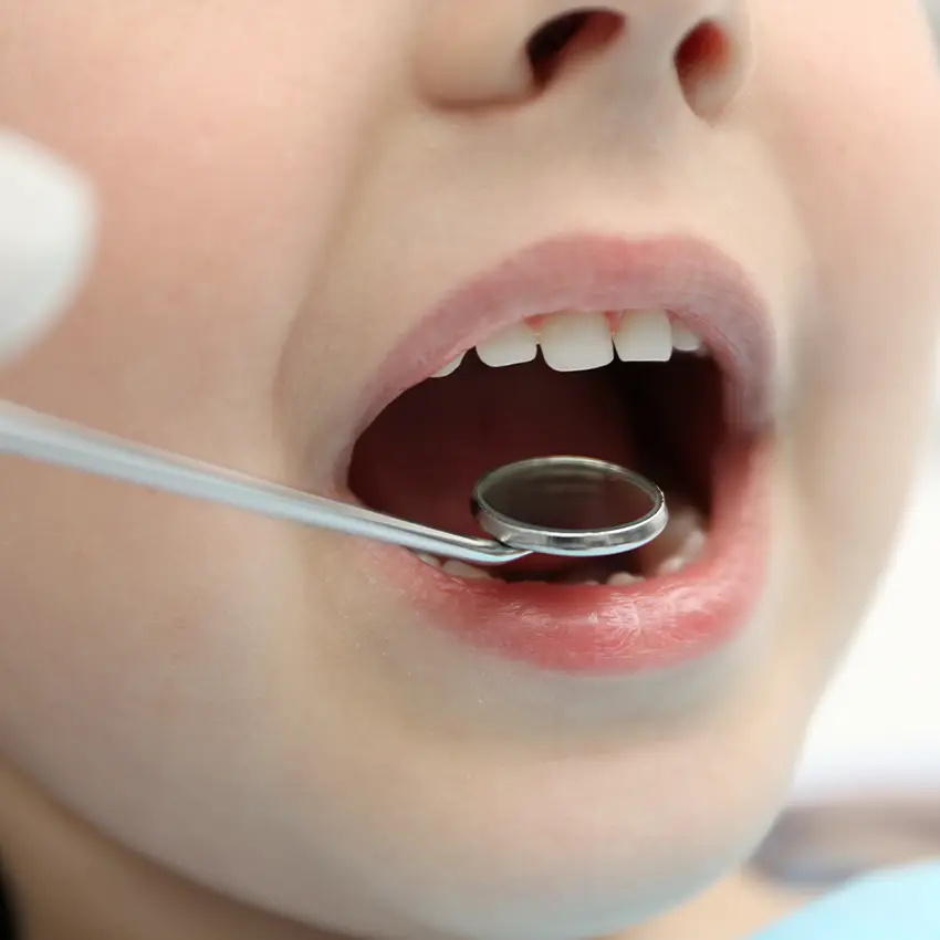 Dental checkup for kids