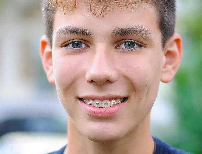 Teen with braces in Carlsbad, CA