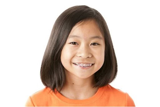 smiling girl with braces from Dr. Yang at Discovery Childrens Dentistry & Orthodontics
